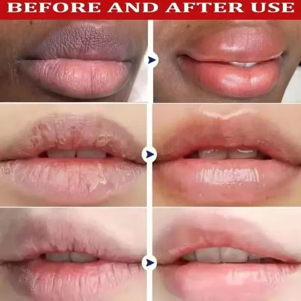 Fast-Lighten-Melanin-Lip-Mask-Remove-Dark-Lip-Balm-Serum-Exfoliating-Fade-Lip-Lines-Dead-Skin.png