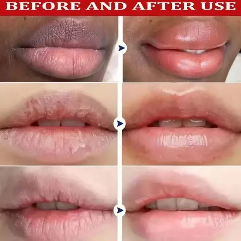 Glow Lip Renewal Mask